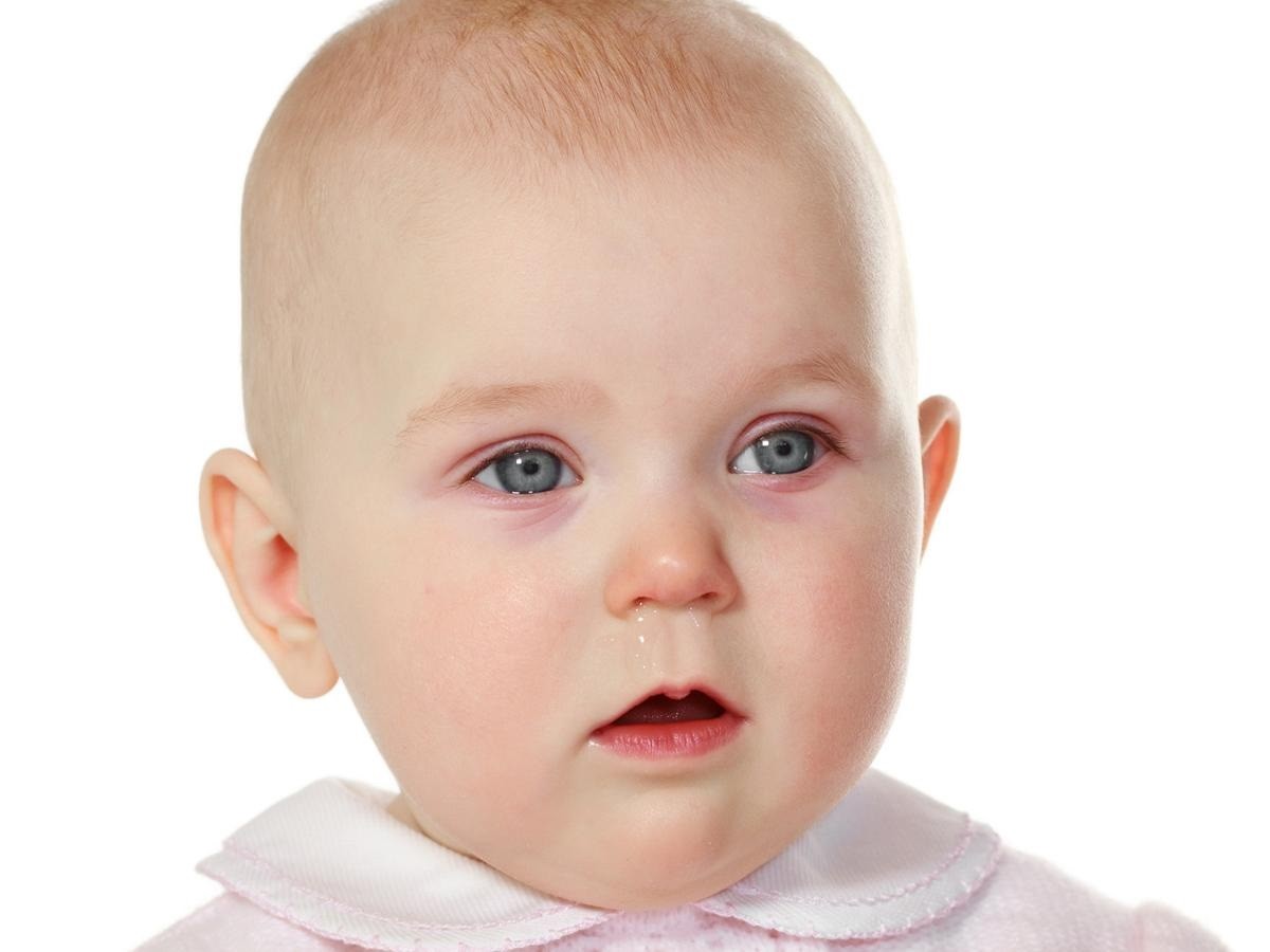 Occhi rossi e congiuntivite nei bambini:cause e rimedi.